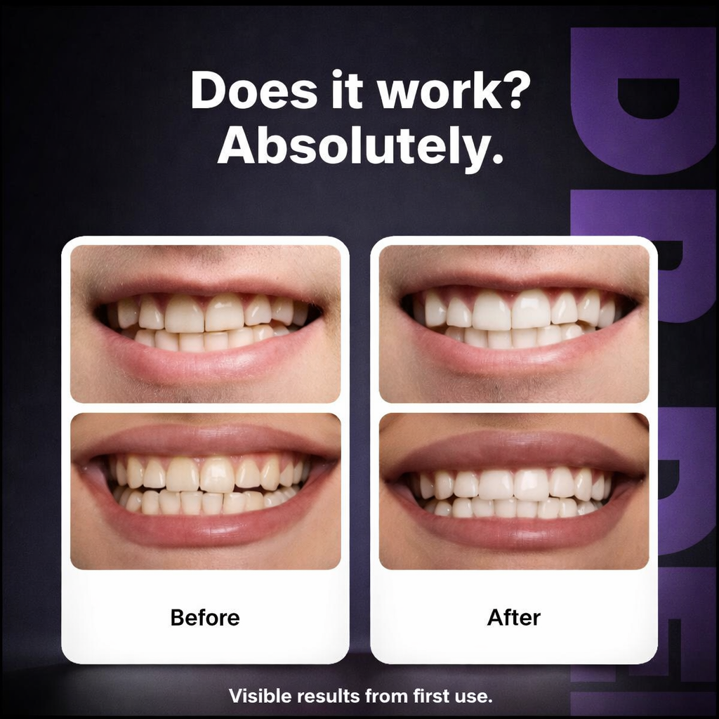 BrightDent™ Professional Whitening Strips